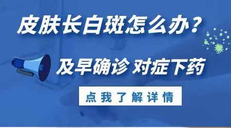 预防白癜风反复出现要注意哪些问题?